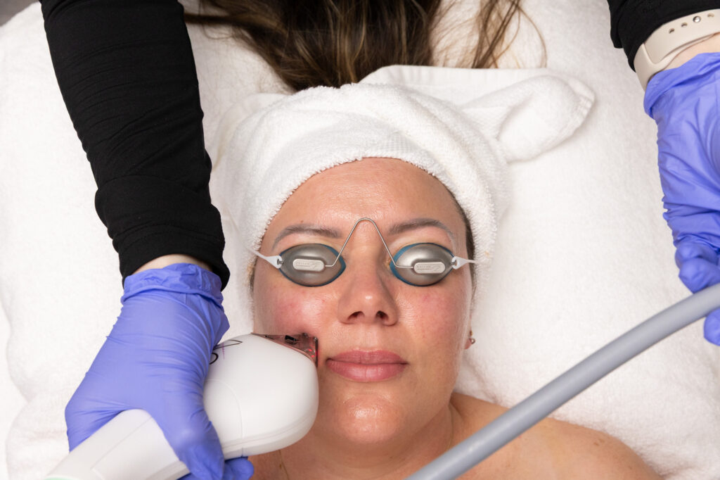 A woman sits back as a provider performs laser therapy for dark spots in Kansas City, MO