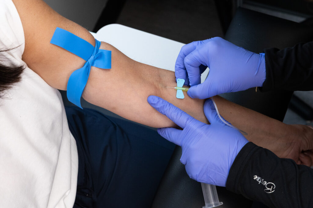 A patient receives a blood draw for a plasma-rich injection in Kansas City