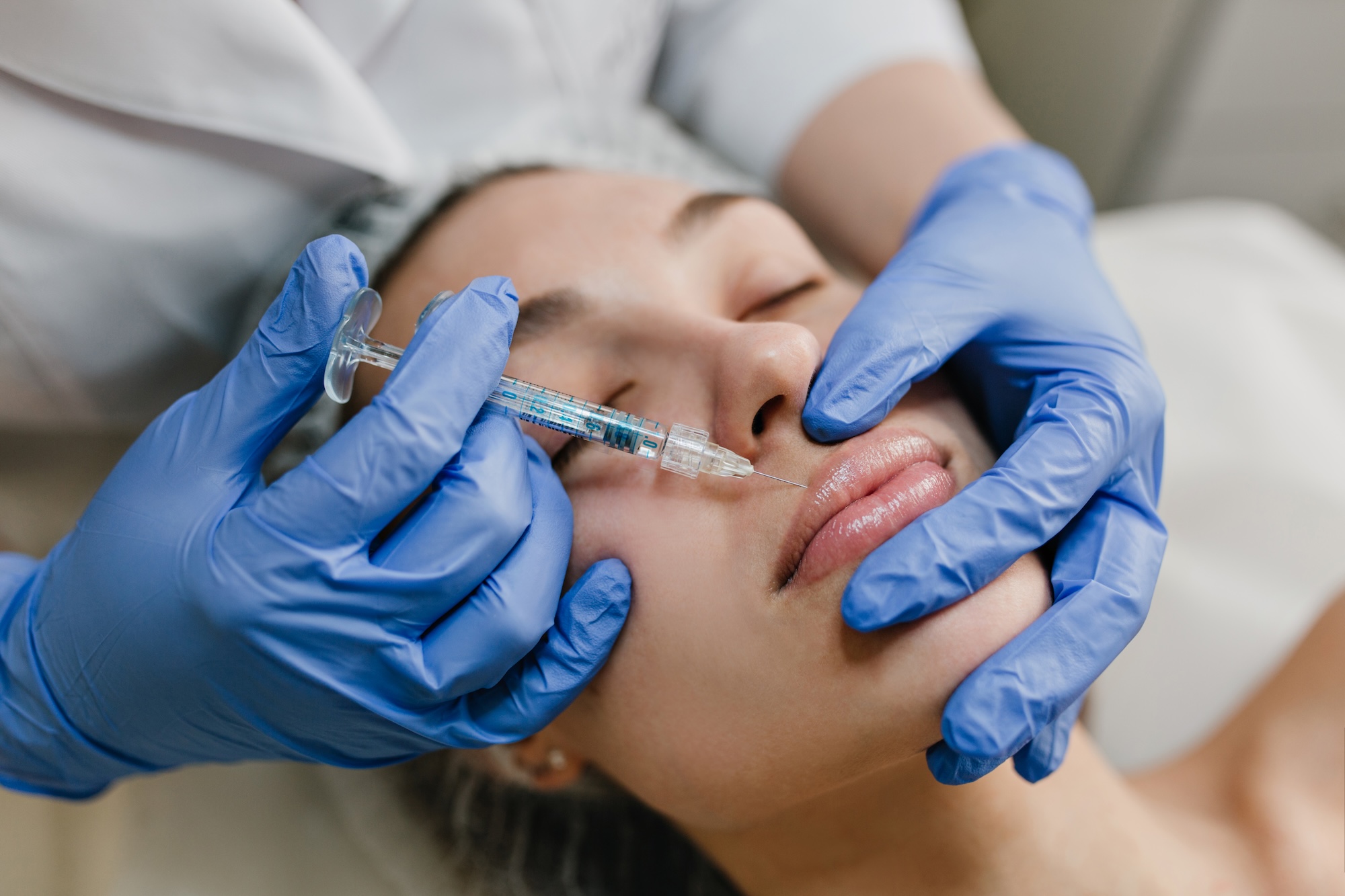 A young woman lies back on a treatment table while a provider wearing gloves uses a syringe to precisely inject lip fillers in Kansas City.